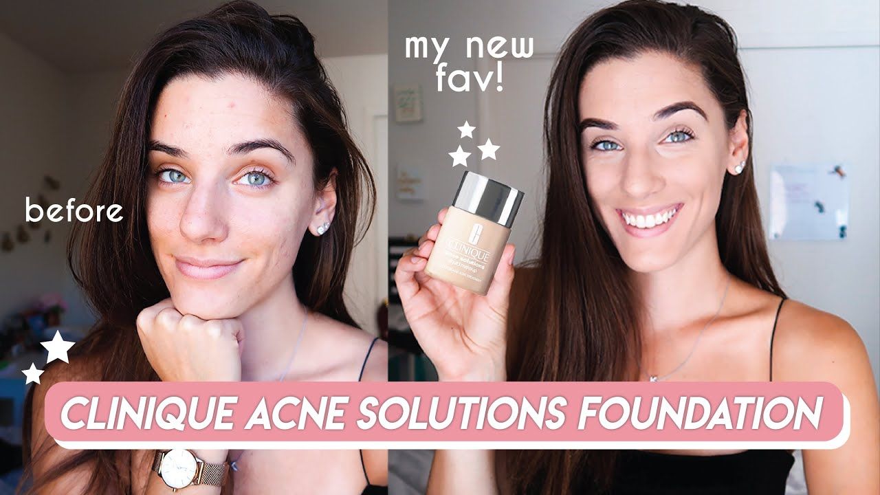 Acne Solutions for Women of All Ages